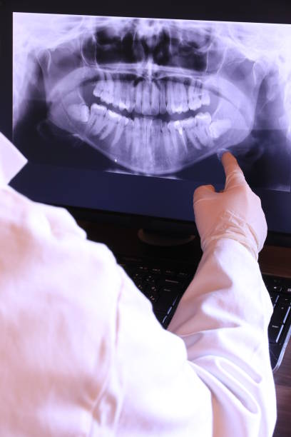 Best Emergency Dentist for Lost Fillings or Crowns in Grover, WY