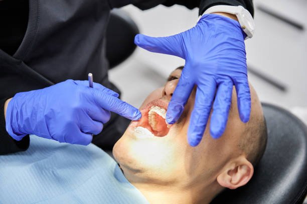 Best Emergency Dental Care for Abscessed Tooth in Grover, WY